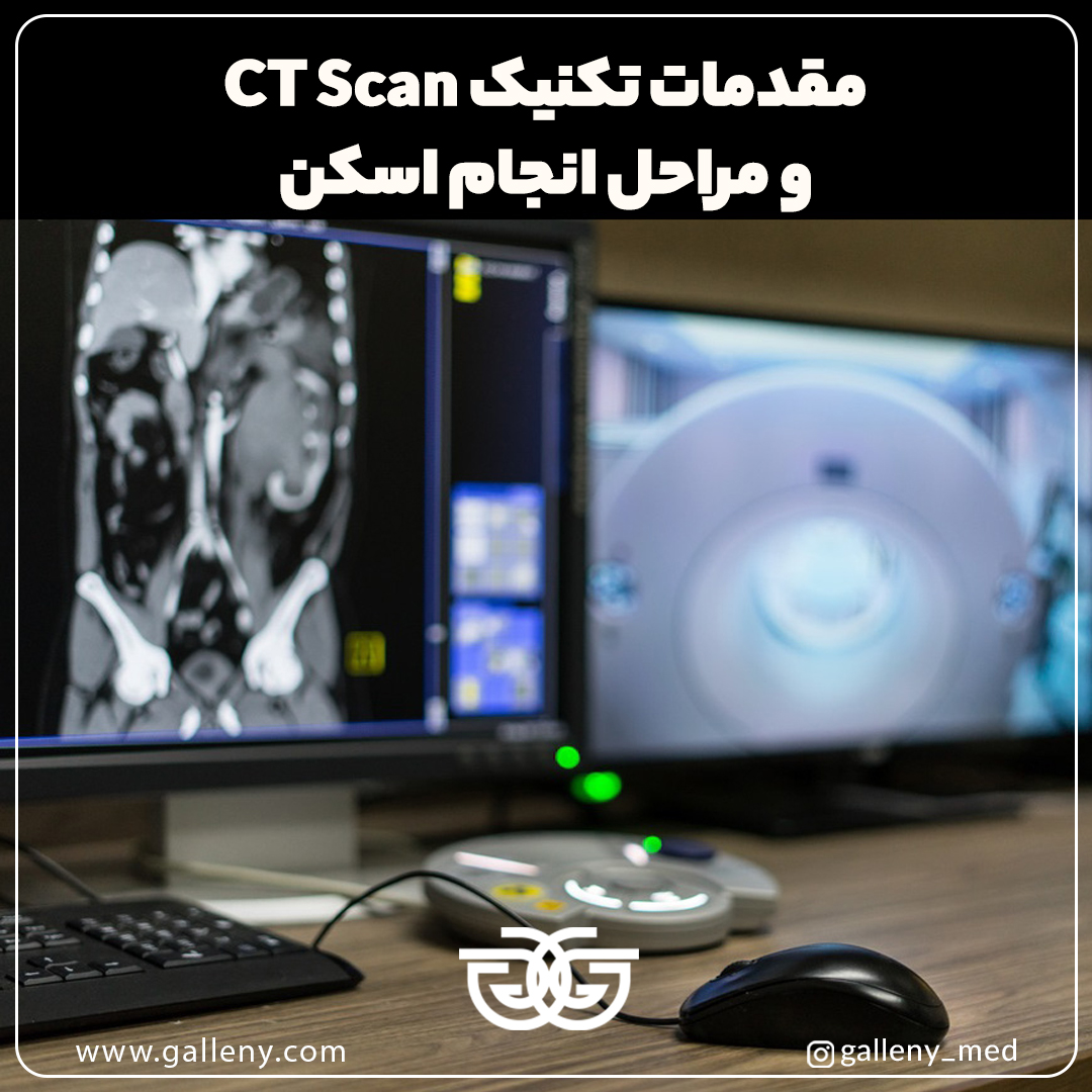 تکنیک های CT scan
